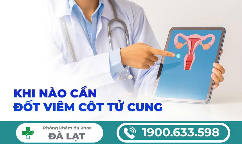 Hình ảnh minh họa